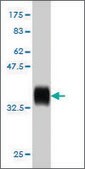 Monoclonal Anti-HOXD11 antibody produced in mouse clone 8F10, purified immunoglobulin, buffered aqueous solution