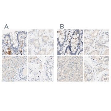 Anti-MANEA antibody produced in rabbit Ab1, Prestige Antibodies&#174; Powered by Atlas Antibodies, affinity isolated antibody, buffered aqueous glycerol solution