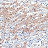 [KO Validated]Anti-Smad4 Antibody, clone 1H7D3, Rabbit Monoclonal