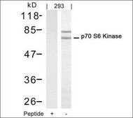 Anti-RPS6KB1 (Ab-421) antibody produced in rabbit affinity isolated antibody