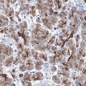 Anti-RAB3IP antibody produced in rabbit Prestige Antibodies® Powered by Atlas Antibodies, affinity isolated antibody, buffered aqueous glycerol solution