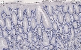 Anti-MUC5AC Antibody, clone CLH2 ZooMAb&#174; Mouse Monoclonal recombinant, expressed in HEK 293 cells