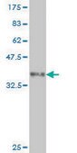 Monoclonal Anti-OXSR1 antibody produced in mouse clone 2E9, purified immunoglobulin, buffered aqueous solution