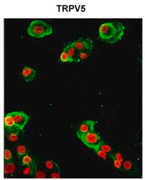 Anti-TRPV5 antibody produced in rabbit affinity isolated antibody