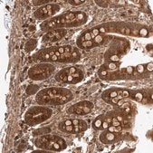 Anti-ZNF649 antibody produced in rabbit Prestige Antibodies&#174; Powered by Atlas Antibodies, affinity isolated antibody, buffered aqueous glycerol solution