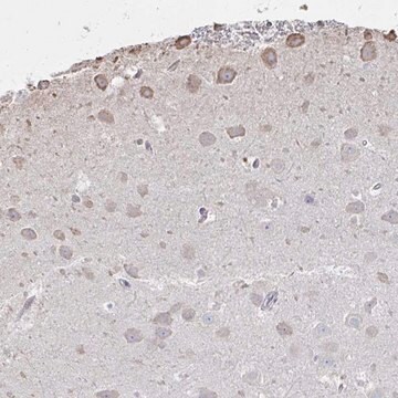 Anti-C20orf24 antibody produced in rabbit Prestige Antibodies&#174; Powered by Atlas Antibodies, affinity isolated antibody, buffered aqueous glycerol solution