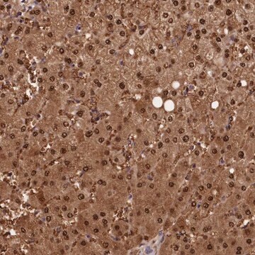 Anti-ACP7 antibody produced in rabbit Prestige Antibodies&#174; Powered by Atlas Antibodies, affinity isolated antibody, buffered aqueous glycerol solution