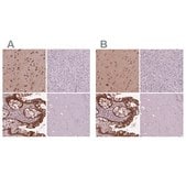Anti-SRI antibody produced in rabbit Prestige Antibodies&#174; Powered by Atlas Antibodies, affinity isolated antibody