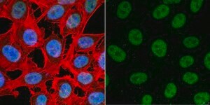 Anti-TATA-Binding-Protein Antibody ascites fluid, Chemicon&#174;