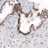 Monoclonal Anti-H2AFY antibody produced in mouse Prestige Antibodies&#174; Powered by Atlas Antibodies, clone CL5256, purified immunoglobulin, buffered aqueous glycerol solution