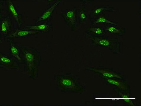 Anti-ZNF668 antibody produced in mouse purified immunoglobulin, buffered aqueous solution