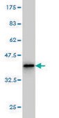 Monoclonal Anti-PTX3 antibody produced in mouse clone 2B10, purified immunoglobulin, buffered aqueous solution
