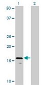 Monoclonal Anti-AGTRAP antibody produced in mouse clone 1G2, purified immunoglobulin, buffered aqueous solution