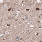 Anti-MECR antibody produced in rabbit Prestige Antibodies&#174; Powered by Atlas Antibodies, affinity isolated antibody, buffered aqueous glycerol solution