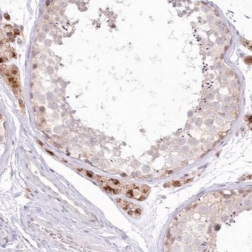 Anti-MTMR3 antibody produced in rabbit Prestige Antibodies&#174; Powered by Atlas Antibodies, affinity isolated antibody, buffered aqueous glycerol solution