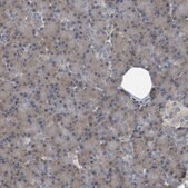 Anti-CDV3 antibody produced in rabbit Prestige Antibodies&#174; Powered by Atlas Antibodies, affinity isolated antibody, buffered aqueous glycerol solution, ab3