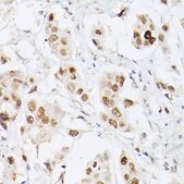 Anti-Pan Lactic acid-Lysine antibody produced in rabbit