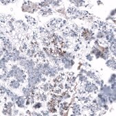 Anti-L1CAM antibody produced in mouse Prestige Antibodies® Powered by Atlas Antibodies, clone CL12988, purified by using Protein A, buffered aqueous glycerol solution