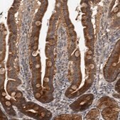 Anti-TRMT61B antibody produced in rabbit Prestige Antibodies&#174; Powered by Atlas Antibodies, affinity isolated antibody, buffered aqueous glycerol solution, Ab2