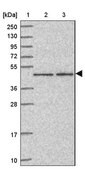 Anti-ZKSCAN7 antibody produced in rabbit Prestige Antibodies® Powered by Atlas Antibodies, affinity isolated antibody, buffered aqueous glycerol solution
