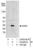 Rabbit anti-CDK2 Antibody, Affinity Purified Powered by Bethyl Laboratories, Inc.