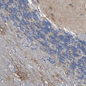 Anti-OTOF antibody produced in rabbit Prestige Antibodies&#174; Powered by Atlas Antibodies, affinity isolated antibody, buffered aqueous glycerol solution