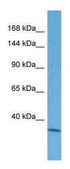 Anti-SRRM2 (C-terminal) antibody produced in rabbit affinity isolated antibody