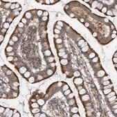 Anti-KIF15 antibody produced in rabbit Prestige Antibodies&#174; Powered by Atlas Antibodies, affinity isolated antibody, buffered aqueous glycerol solution