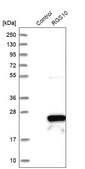 Anti-RGS10 antibody produced in rabbit Prestige Antibodies&#174; Powered by Atlas Antibodies, affinity isolated antibody, buffered aqueous glycerol solution