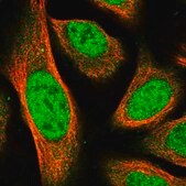 Anti-MPP3 antibody produced in rabbit Prestige Antibodies&#174; Powered by Atlas Antibodies, affinity isolated antibody, buffered aqueous glycerol solution, Ab1