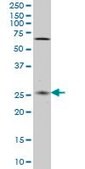 Monoclonal Anti-CNO antibody produced in mouse clone 6C3, purified immunoglobulin, buffered aqueous solution