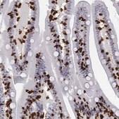 Anti-CD3E antibody produced in rabbit Prestige Antibodies&#174; Powered by Atlas Antibodies, affinity isolated antibody, buffered aqueous glycerol solution