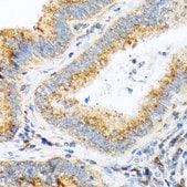Anti-COPA antibody produced in rabbit