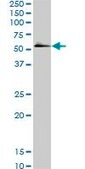 Monoclonal Anti-SMAD5 antibody produced in mouse clone 2D7, purified immunoglobulin, buffered aqueous solution