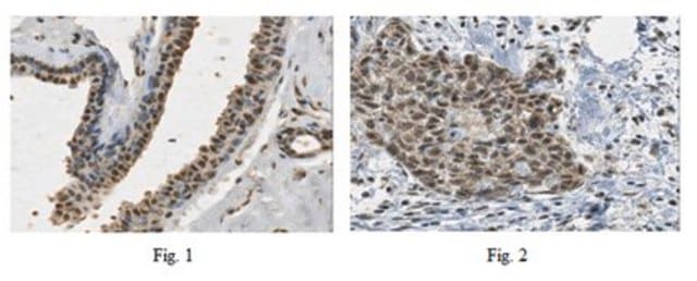 抗-PALB2抗体 from rabbit, purified by affinity chromatography