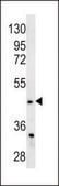 ANTI-FADS2 (CENTER) antibody produced in rabbit IgG fraction of antiserum, buffered aqueous solution
