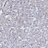 Anti-NRIP2 antibody produced in rabbit Prestige Antibodies&#174; Powered by Atlas Antibodies, affinity isolated antibody, buffered aqueous glycerol solution