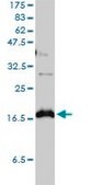 Monoclonal Anti-CLDN1 antibody produced in mouse clone 1C5-D9, purified immunoglobulin, buffered aqueous solution