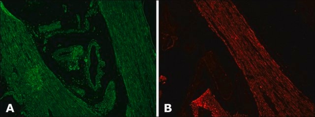 Anti-Desmin antibody produced in rabbit whole antiserum