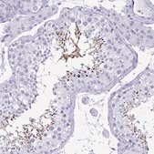 Anti-BPIFA3 antibody produced in rabbit Prestige Antibodies&#174; Powered by Atlas Antibodies, affinity isolated antibody, buffered aqueous glycerol solution
