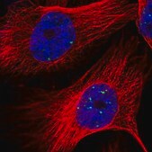 Anti-LYRM4 antibody produced in rabbit Prestige Antibodies® Powered by Atlas Antibodies, affinity isolated antibody, buffered aqueous glycerol solution