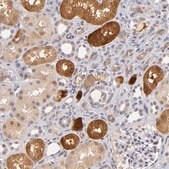 Anti-ZNF205 antibody produced in rabbit Prestige Antibodies&#174; Powered by Atlas Antibodies, affinity isolated antibody, buffered aqueous glycerol solution