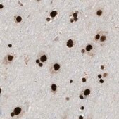 Anti-LUC7L3 antibody produced in rabbit Prestige Antibodies&#174; Powered by Atlas Antibodies, affinity isolated antibody, buffered aqueous glycerol solution, Ab3