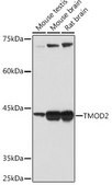 Anti-TMOD2 antibody produced in rabbit