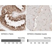 Anti-EIF4G3 antibody produced in rabbit Prestige Antibodies® Powered by Atlas Antibodies, affinity isolated antibody, buffered aqueous glycerol solution, Ab3