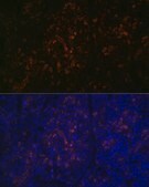 Anti-BTK antibody produced in rabbit