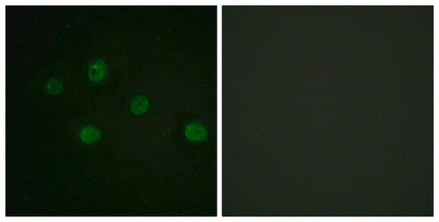 Anti-DNA-PK antibody produced in rabbit affinity isolated antibody