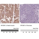 Anti-MYOM1 antibody produced in rabbit Prestige Antibodies® Powered by Atlas Antibodies, affinity isolated antibody, buffered aqueous glycerol solution