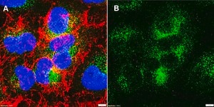 Anti-MX1/MxA Antibody, clone 2C20 ZooMAb&#174; Rabbit Monoclonal recombinant, expressed in HEK 293 cells