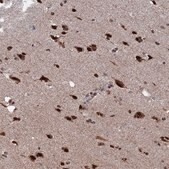 Anti-CTB-50L17.10 antibody produced in rabbit Prestige Antibodies® Powered by Atlas Antibodies, affinity isolated antibody, buffered aqueous glycerol solution